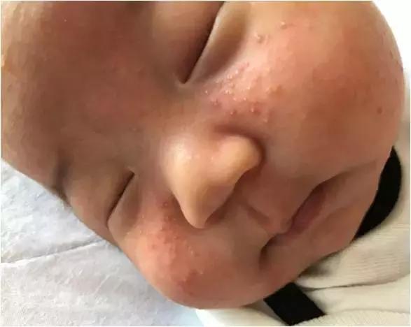 儿保体检有多坑,儿保体检准确么