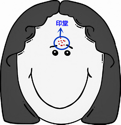 面部痘痘严重程度检测,痘痘面部分析