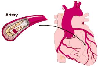 类风湿性关节炎的护理措施,类风湿性关节炎如何保护关节功能