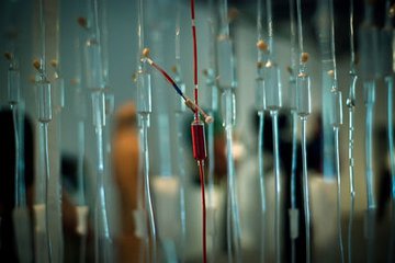 肾病患者如何治疗感冒,肾病患者感冒吃什么感冒药