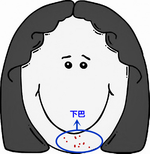 面部痘痘严重程度检测,痘痘面部分析