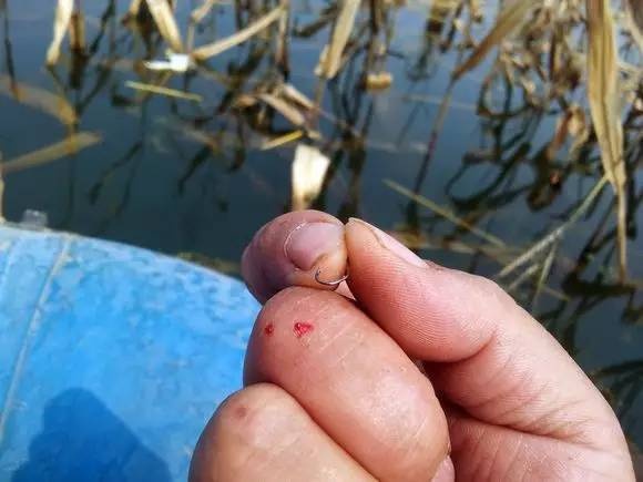 鱼钩倒刺刺进肉里怎么弄出来,有倒刺的鱼钩扎到肉如何取