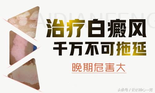 白癜风靠饮食自愈了是真的假的,因精神紧张引起的白癜风会自愈吗
