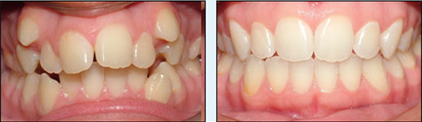 口腔医生怎么消除拔牙恐惧,对拔牙有恐惧怎么缓解