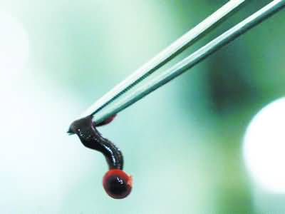 养殖蚂蟥的收益如何,广西养殖蚂蟥致富