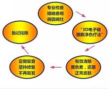 治疗胎记后的人生劫难,我的胎记全集