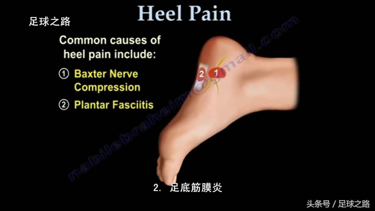 足跟痛最常见病因,足跟痛警惕四种疾病