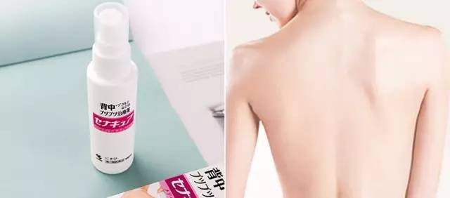 祛除背部痘痘神器,消除痘痘的好产品