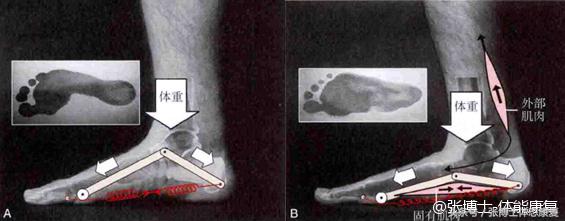 怎么站立可以改善足弓塌陷,如何站立练背