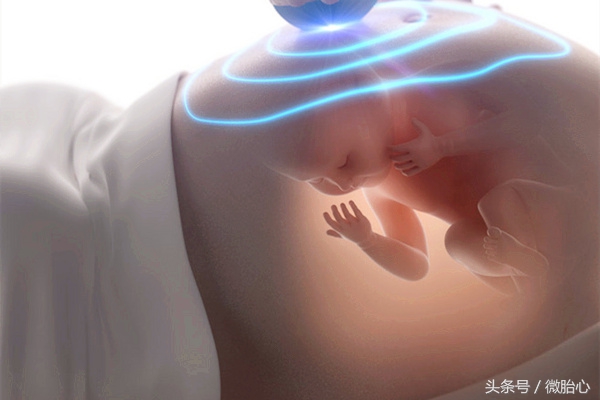 会导致妈妈早产的原因,有早产史如何预防再次早产