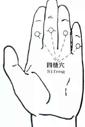 宝宝积食要怎么办才能最快最有效,宝宝积食怎么办最好最快