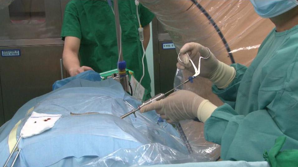 腰椎间盘突出能够完全治好吗,腰椎间盘突出能够手术吗