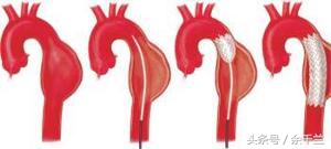 晚上牙疼去医院急诊科可以吗,牙疼通宵熬夜住院进了icu