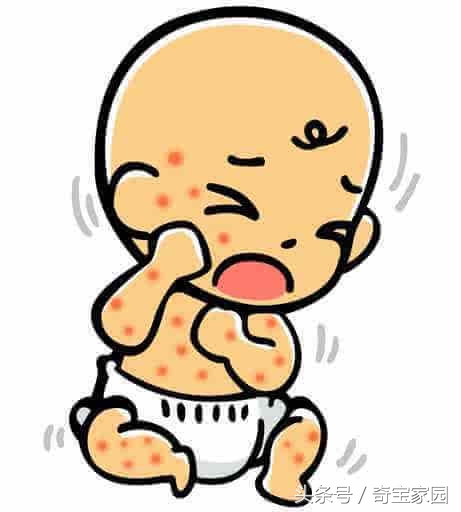 宝宝热疹治疗方法,宝宝热疹反复发作如何除根
