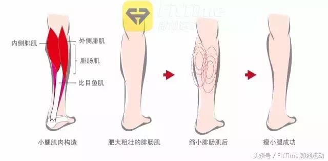 有什么瘦小腿的方法,你们要怎么才能瘦下来