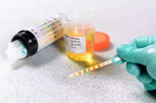 痛风患者碳酸氢钠怎么用,痛风吃碳酸氢钠片有什么作用