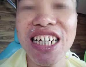 牙齿矫正特惠价3980,牙齿矫正特惠0元体验免费报名