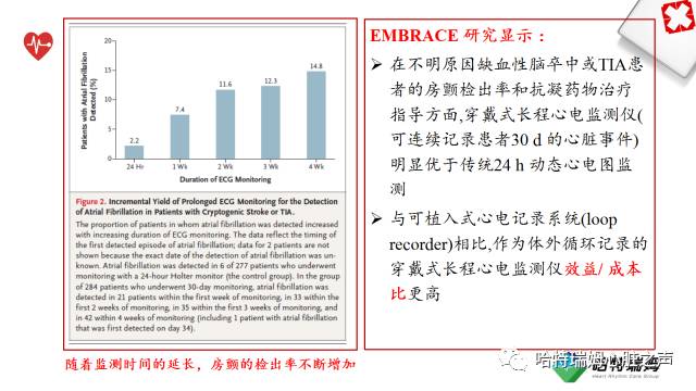 「心声」长程心电检测设备在房颤管理中的重要地位