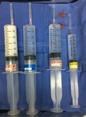 围手术期个案护理比赛优秀案例ppt,术后镇痛的规范化管理ppt