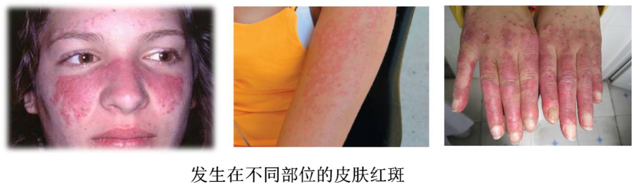 爸妈说你“二天”一定要得的这种病，到底是个啥子病？