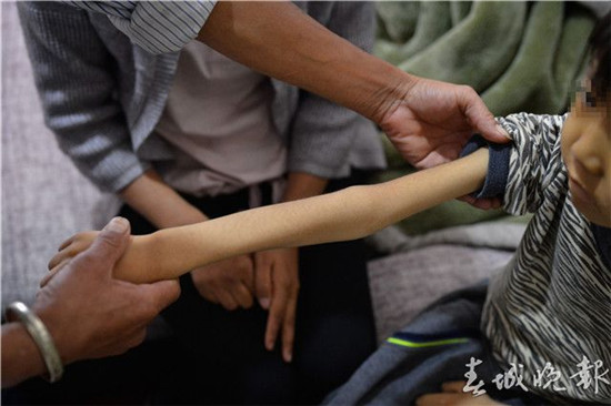 霍奇金淋巴瘤彻底治愈需要多少钱,9岁男孩白血病治疗费用