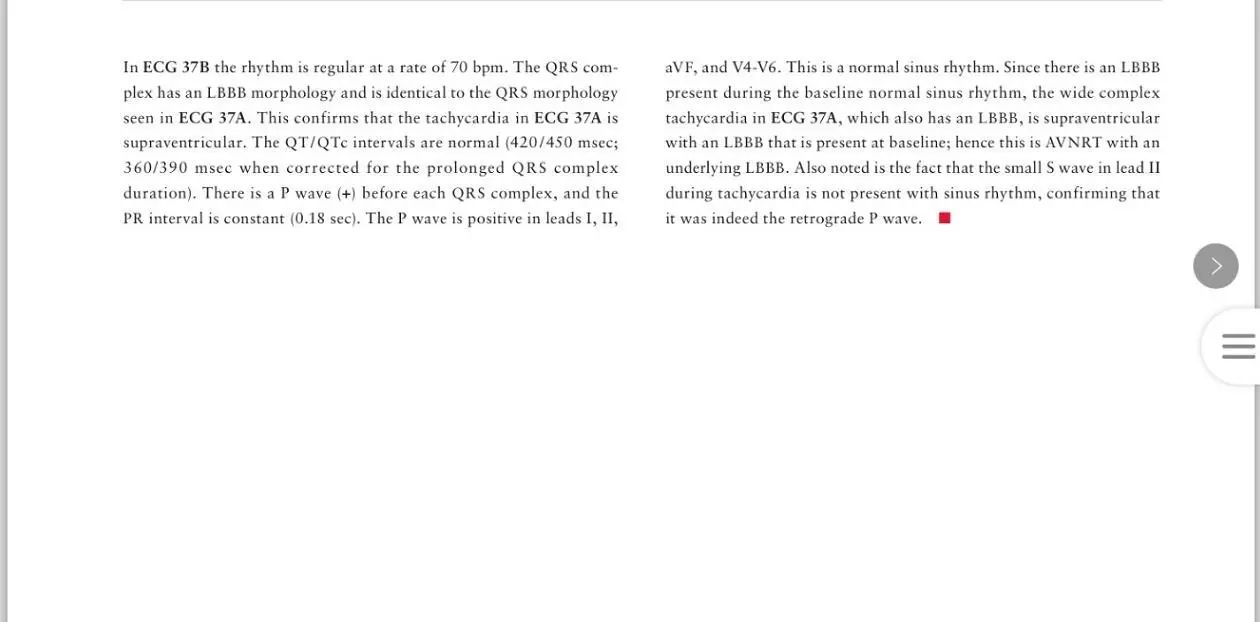 读心有术100期,读心有术171