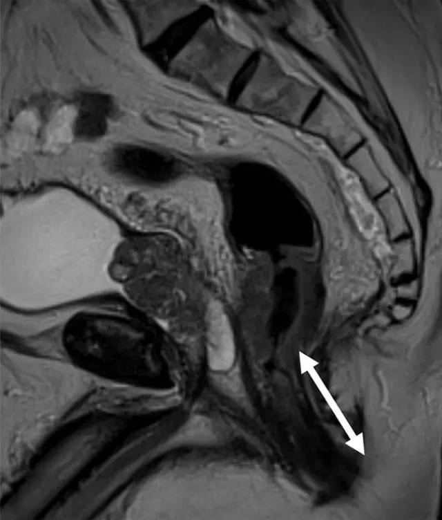 记住一个单词的一般方法,记住癌症九字诀