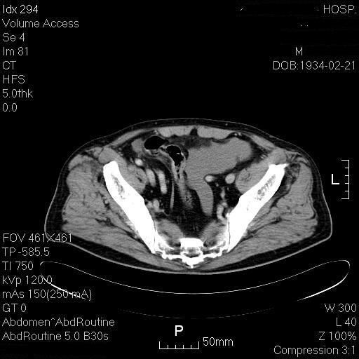 为什么腹痛会引起面色苍白,腹痛未明确原因可以输液吗