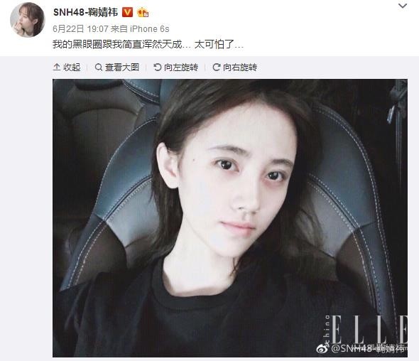 郑爽的演技是被她的黑眼圈耽误了吗？！90后的最大的肌肤危机就是它！