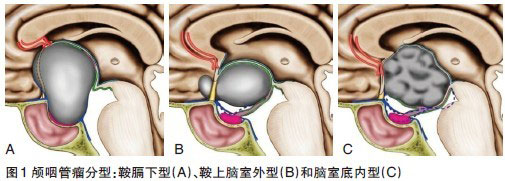 小悦悦为什么会离世,小岳岳最后怎么死的
