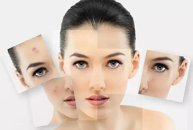 一个地方反反复复长痘是什么原因,不同位置超详细的长痘原因剖析