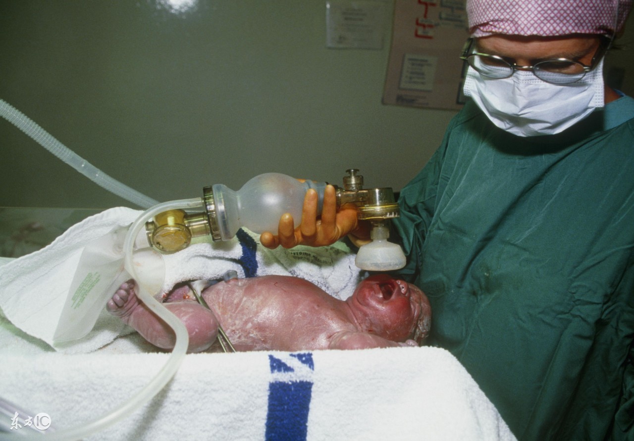 低置胎盘生产过程,胎盘低置顺产还是剖腹产