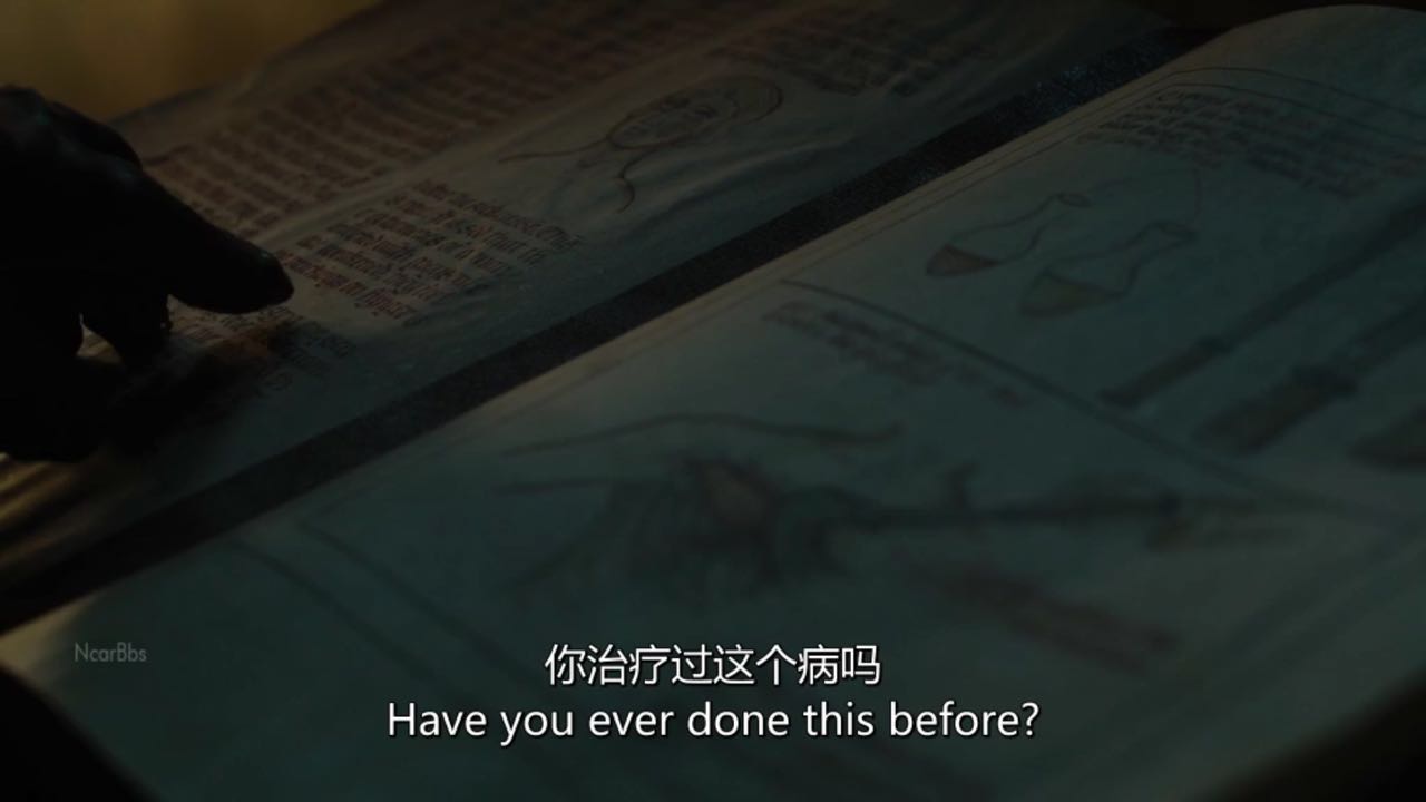 山姆为乔拉爵士刮皮治疗灰麟病你们觉得乔拉会好起来吗?