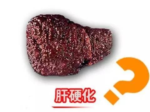 老人80几岁肚子发烧怎么回事,80多岁老人卧床发烧39度多吃什么