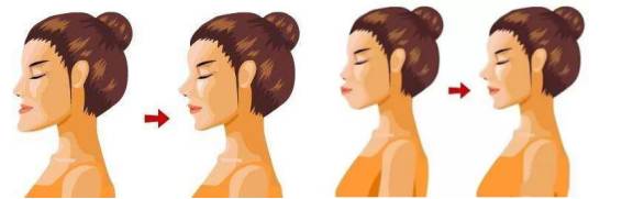 戴牙套为什么会矫正,牙套贵的和便宜的区别