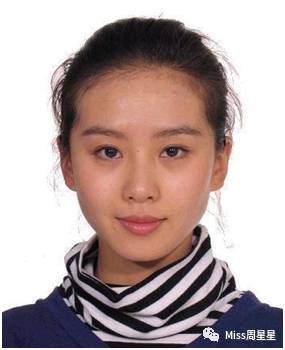 严重黑眼圈的治愈经历,千年黑眼圈解决方案