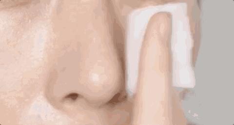 黑头粉刺怎么解决不留坑,挤黑头粉刺小妙招