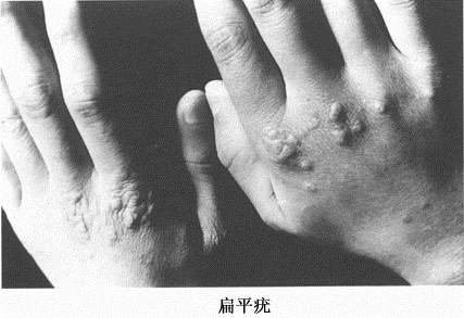 理发师号称养生治疾病,骗女子*款贷**20万办疗程,到底是什么病