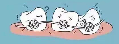 网上买牙套矫正牙齿靠谱吗,拼多多的牙套能矫正牙齿吗