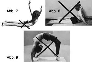 针灸治疗脊柱侧弯的最好方法,脊柱侧弯如何治疗才正确有效