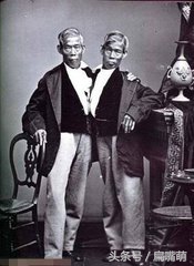 连体婴儿真实存在吗,连体婴到底算一个人还是两个人