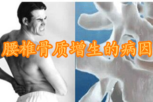 康骨堂导致骨质增生的病因有哪些,腰椎2至5节骨质增生怎么治疗
