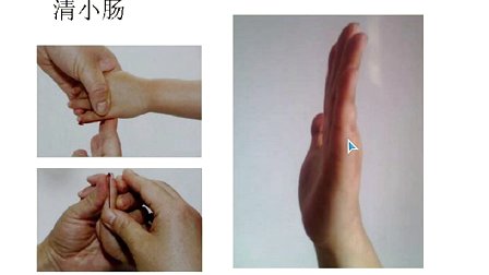 小儿湿疹的推拿方法,宝宝脚上长湿疹小儿推拿按哪