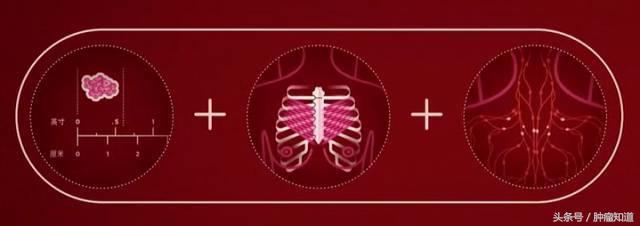 3阴性乳腺癌2期能治好吗,乳腺癌3期a是什么意思