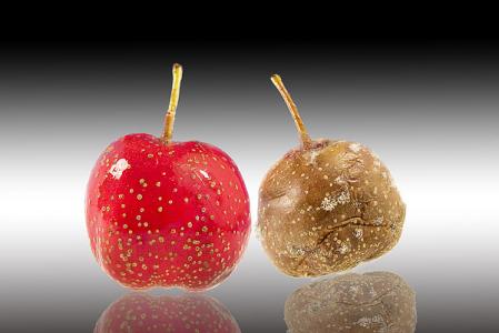 甲状腺b超检查出斑块有事吗,甲状腺b超检查单有血流信号