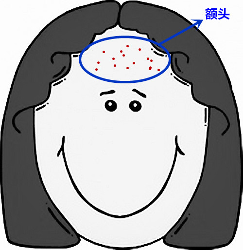 超级齐全的痘痘护理，有痘痘的妹子抓紧收藏