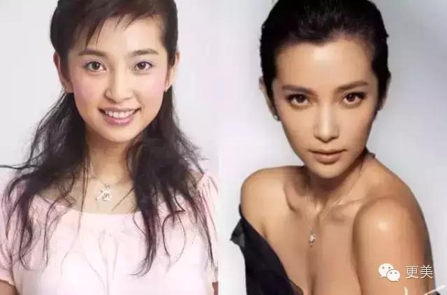 埋线美容线和不吸收线有什么区别,医院埋线和美容院埋线有什么差别