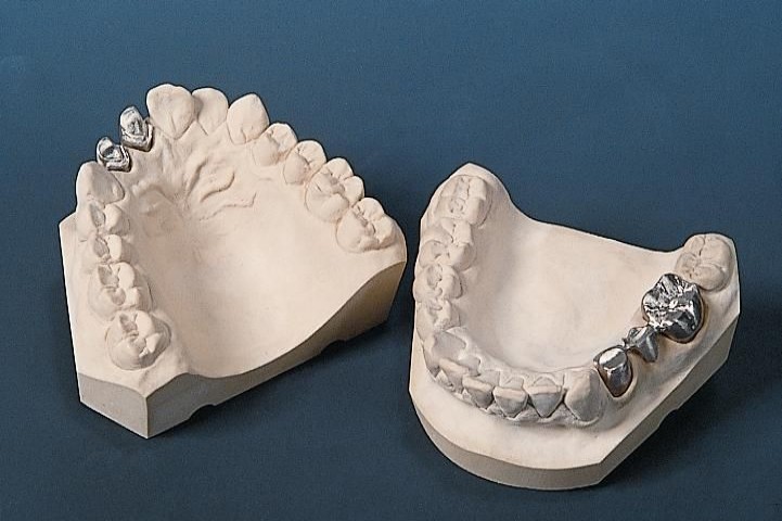 义齿怎么辨别真假,学会三招让你远离伪劣义齿