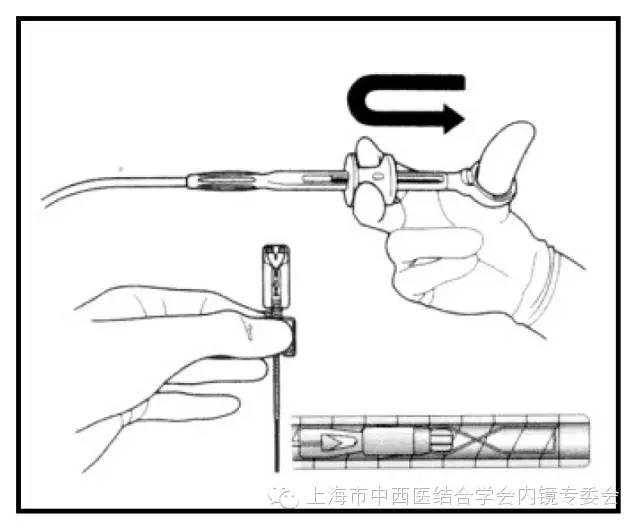 消化内镜仪器操作,消化内镜护理操作名称