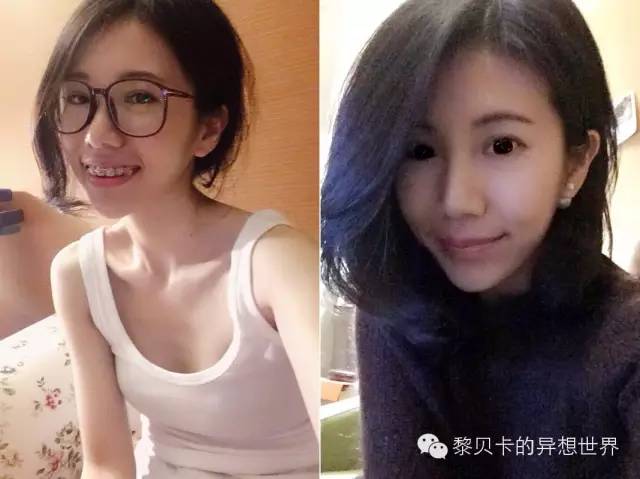 她们说||那些年整牙吞下的血和泪,终于换来最开怀的大笑